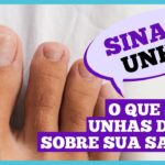 Dr. Ajuda: Unhas fracas podem indicar problemas de saúde