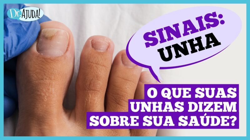 Dr. Ajuda: Unhas fracas podem indicar problemas de saúde