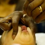 POLIOMIELITE: dose inativada traz mais segurança ao esquema vacinal