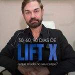 Lift X: o novo queridinho entre os tratamentos faciais promete rejuvenescimento natural em até 90 dias