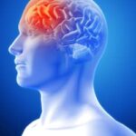 Casos de meningite crescem na Baixada Santista, o que alerta autoridades