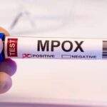 Mpox: Brasil registra 88 casos em seis estados e no DF em 2026; saiba mais sobre a doença